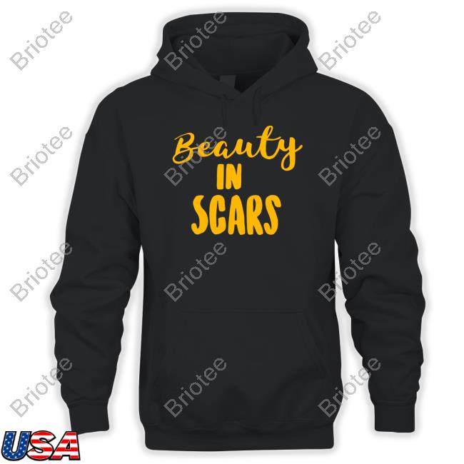 Beauty In Scars Shirt